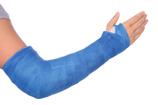 Sprains_Strains_and_Fractures, osteoporosis, stress fractures, signs of osteoporosis, symptoms of osteoporosis, osteoporosis treatment