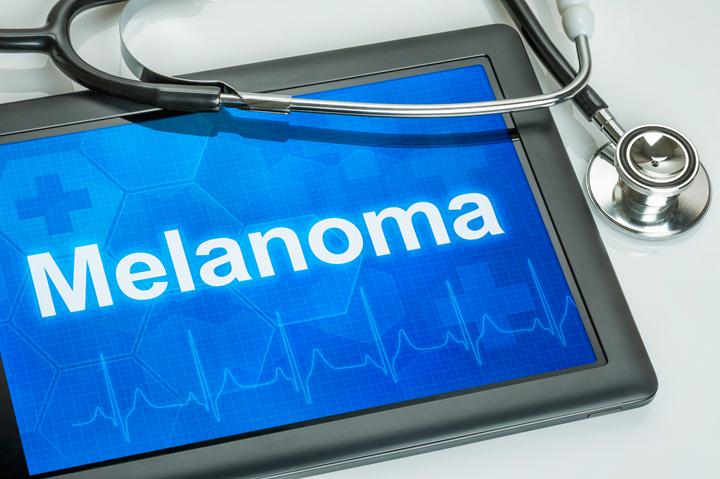 Understanding Metastatic Melanoma