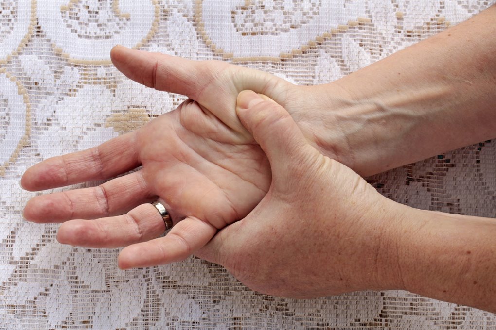 The Symptoms of Rheumatoid Arthritis