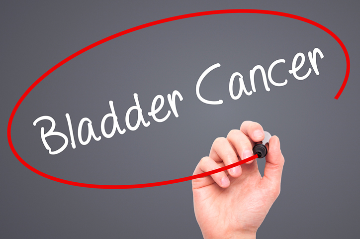What Causes Bladder Cancer?
