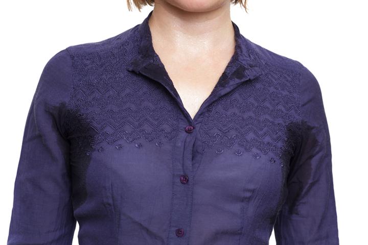 Symptoms and Treatment of Hyperhidrosis