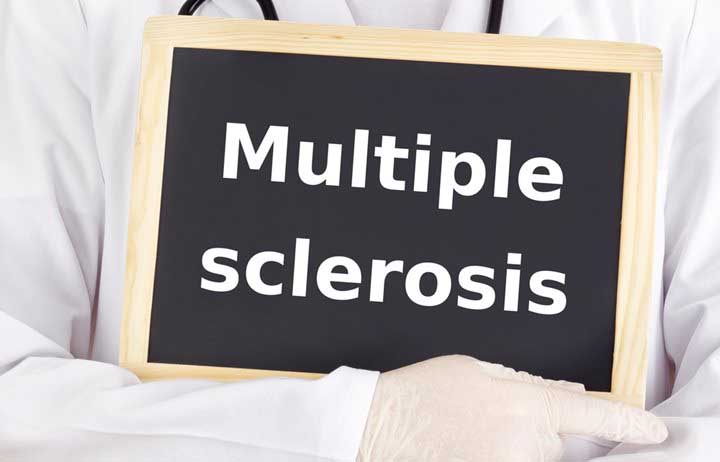 4 Types of Multiple Sclerosis and Treatment Options
