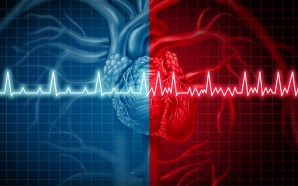 AFib: Everything You Need to Know
